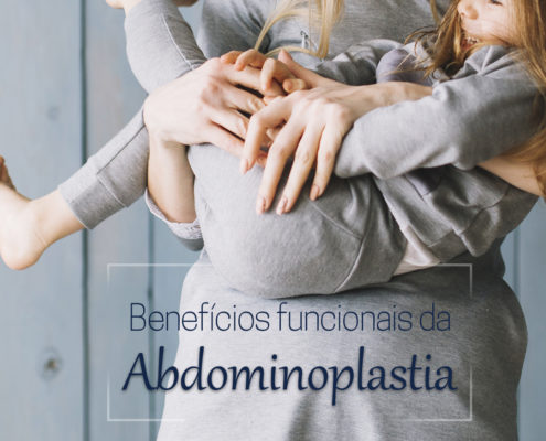 BENEFÍCIOS FUNCIONAS DRA ABDOMINOPLASTIA - Dra. Tatiana Abdala SALVADOR/BAHIA